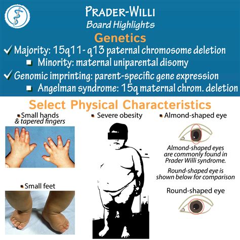 characteristics of prader willi syndrome.